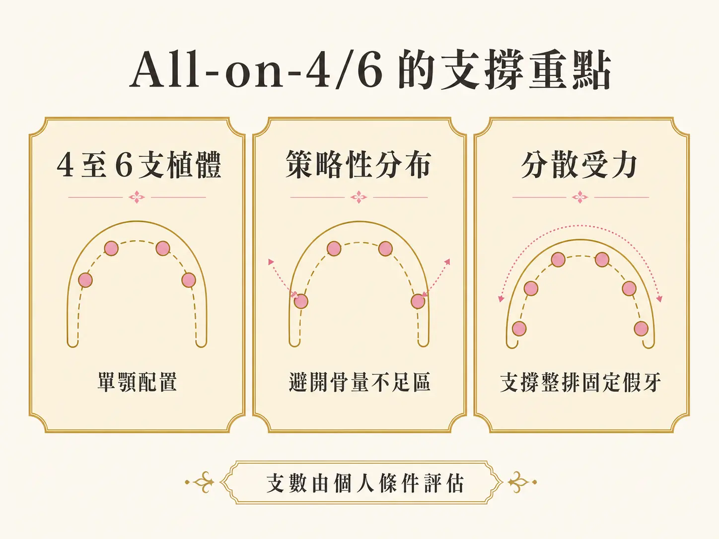 一日全口重建是什麼?All-on-4/6 當天裝牙原理與條件 All-on-4/6 以 4 至 6 支植體策略性分布並分散受力,支數需依個人條件評估。
